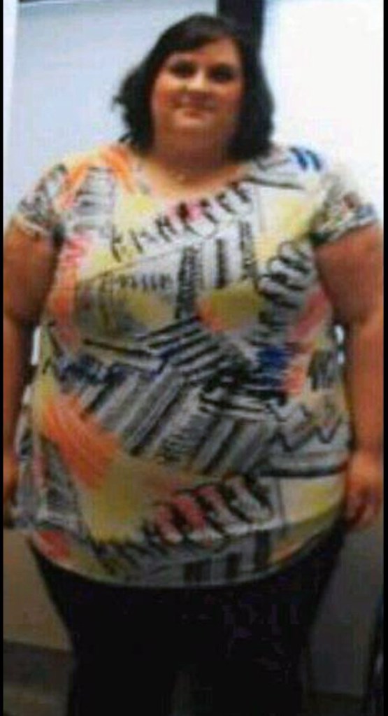 At her heaviest in 2011, Shannon Britton weighed 486 pounds. This photo was taken 10 days before her gastric bypass surgery on November 23.