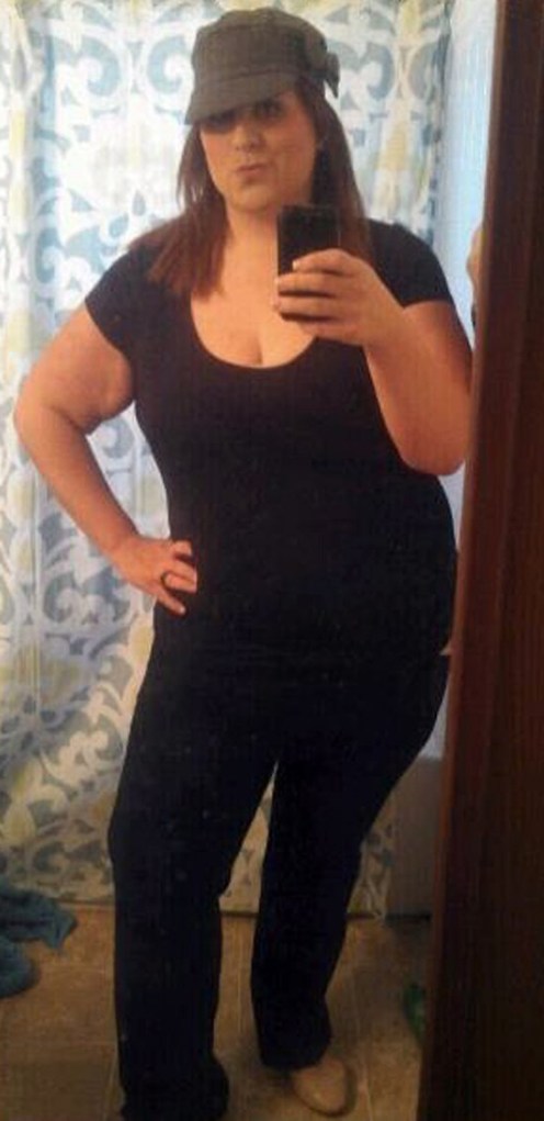 One year after her surgery, Britton was down to 300 pounds.